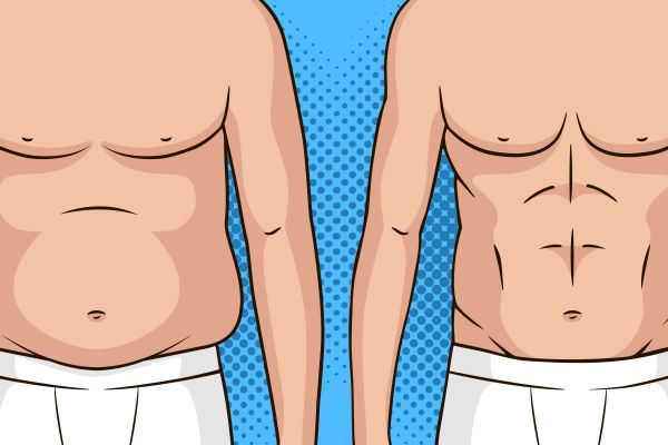 abdominoplastia en España