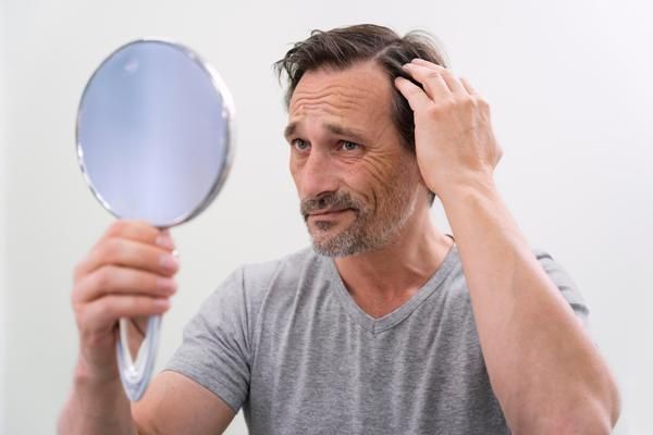 Minoxidil