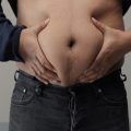 mejores clínicas de intralipoterapia en Madrid