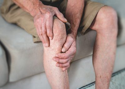 Las 3 mejores clínicas de escleroterapia en Madrid